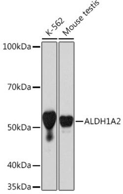 Invitrogen ALDH1A2 Recombinant Rabbit Monoclonal Antibody (3D2P3) 100 &mu;L;