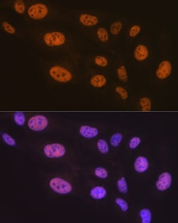 Invitrogen PTBP2 Recombinant Rabbit Monoclonal Antibody (10S9P6) 100 &mu;L;