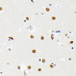 Invitrogen PTBP2 Recombinant Rabbit Monoclonal Antibody (10S9P6) 100 &mu;L;