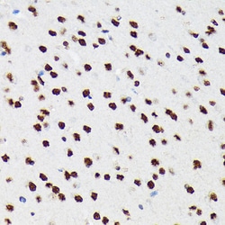 Invitrogen PTBP2 Recombinant Rabbit Monoclonal Antibody (10S9P6) 100 &mu;L;