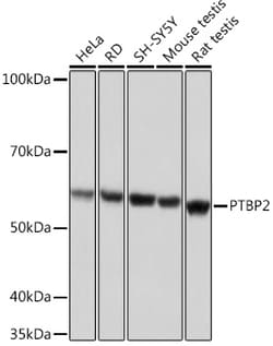 Invitrogen PTBP2 Recombinant Rabbit Monoclonal Antibody (10S9P6) 100 &mu;L;