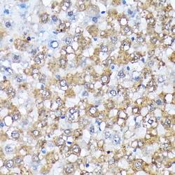Invitrogen CK1 alpha Recombinant Rabbit Monoclonal Antibody (9O4L9) 100