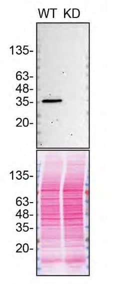 Invitrogen CK1 alpha Recombinant Rabbit Monoclonal Antibody (9O4L9) 100