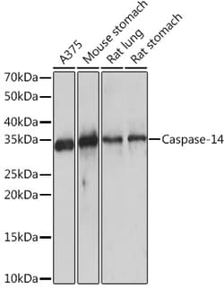 Invitrogen Caspase 14 Recombinant Rabbit Monoclonal Antibody (6E2C1) 100