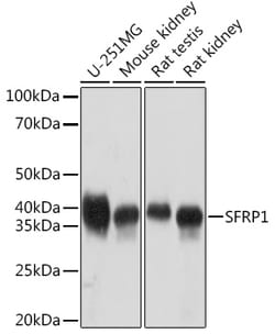 Invitrogen SFRP1 Recombinant Rabbit Monoclonal Antibody (5I6V1) 100 &mu;L;