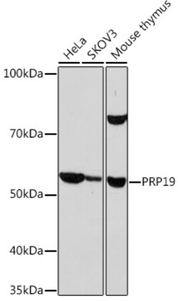 Invitrogen PRP19 Recombinant Rabbit Monoclonal Antibody (4M3Z1) 100 &mu;L | Buy Online | Invitrogen&trade; | Fisher Scientific