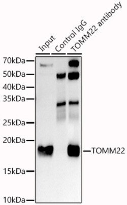 Invitrogen TOMM22 Recombinant Rabbit Monoclonal Antibody (6R1L7) 100 &mu;L;