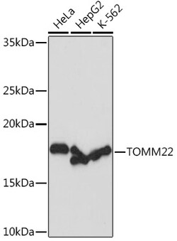 Invitrogen TOMM22 Recombinant Rabbit Monoclonal Antibody (6R1L7) 100 &mu;L;