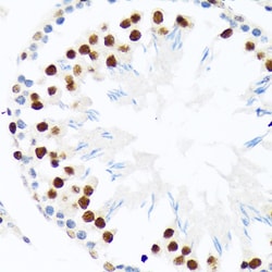Invitrogen PIAS1/PIAS2 Recombinant Rabbit Monoclonal Antibody (8P1D2) 100