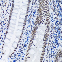 Invitrogen PIAS1/PIAS2 Recombinant Rabbit Monoclonal Antibody (8P1D2) 100