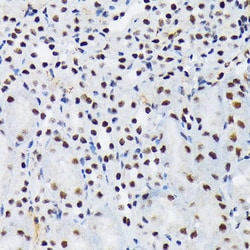 Invitrogen PIAS1/PIAS2 Recombinant Rabbit Monoclonal Antibody (8P1D2) 100