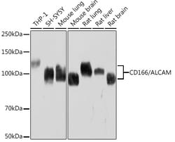 CD166 (ALCAM) Recombinant Rabbit Monoclonal Antibody (6Z4Y2):Antibodies,