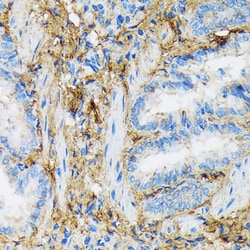 Invitrogen Collagen VI Recombinant Rabbit Monoclonal Antibody (7J1P4) 100