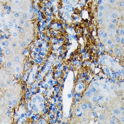 Invitrogen Collagen VI Recombinant Rabbit Monoclonal Antibody (7J1P4) 100