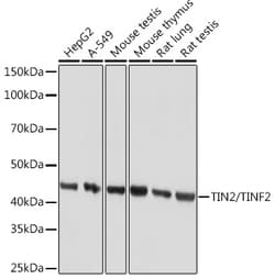 Invitrogen TIN2 Recombinant Rabbit Monoclonal Antibody (4W5P2) 100 &mu;L;