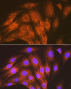 Invitrogen ACVRL1 Recombinant Rabbit Monoclonal Antibody (8L2V7) 100 &mu;L;