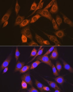 Invitrogen ACVRL1 Recombinant Rabbit Monoclonal Antibody (8L2V7) 100 &mu;L;