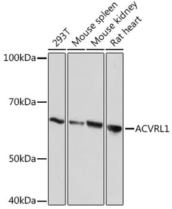 Invitrogen ACVRL1 Recombinant Rabbit Monoclonal Antibody (8L2V7) 100 &mu;L;