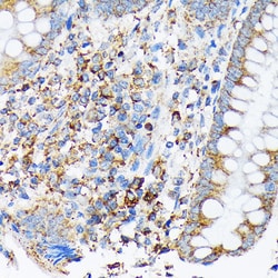 Cdc25B Recombinant Rabbit Monoclonal Antibody (4D5S10):Antibodies, Recombinant