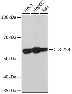 Cdc25B Recombinant Rabbit Monoclonal Antibody (4D5S10):Antibodies, Recombinant