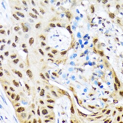 Invitrogen HES5 Recombinant Rabbit Monoclonal Antibody (4S4U7) 100 &mu;L;