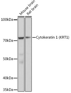 Invitrogen Cytokeratin 1 Recombinant Rabbit Monoclonal Antibody (10W8J6) 100 &mu;L | Buy Online | Invitrogen&trade; | Fisher Scientific