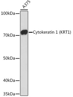 Invitrogen Cytokeratin 1 Recombinant Rabbit Monoclonal Antibody (10W8J6) 100 &mu;L | Buy Online | Invitrogen&trade; | Fisher Scientific