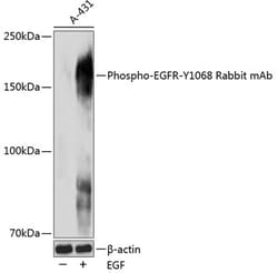 Invitrogen Phospho-EGFR (Tyr1068) Recombinant Rabbit Monoclonal Antibody (6B9U4) 100 &mu;L | Buy Online | Invitrogen&trade; | Fisher Scientific