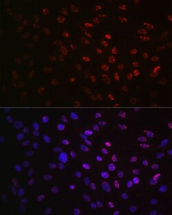 Invitrogen Phospho-p70 S6 Kinase (Thr421) Recombinant Rabbit Monoclonal