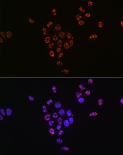 Invitrogen Phospho-p70 S6 Kinase (Thr421) Recombinant Rabbit Monoclonal