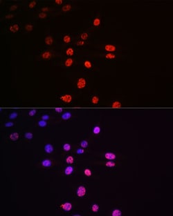 Invitrogen Phospho-p70 S6 Kinase (Thr421) Recombinant Rabbit Monoclonal