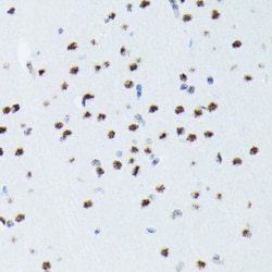 Invitrogen Phospho-p70 S6 Kinase (Thr421) Recombinant Rabbit Monoclonal