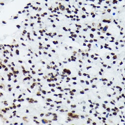 Invitrogen Phospho-p70 S6 Kinase (Thr421) Recombinant Rabbit Monoclonal