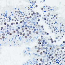 Invitrogen Phospho-p70 S6 Kinase (Thr421) Recombinant Rabbit Monoclonal