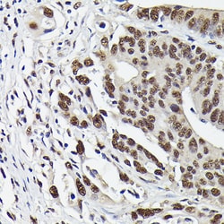 Invitrogen Phospho-SMAD3 (Ser423) Recombinant Rabbit Monoclonal Antibody