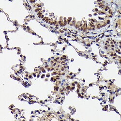 Invitrogen Phospho-SMAD3 (Ser423) Recombinant Rabbit Monoclonal Antibody