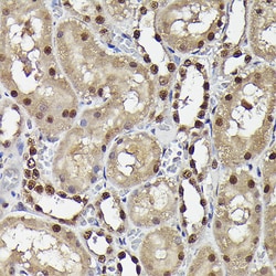 Invitrogen Phospho-SMAD3 (Ser423) Recombinant Rabbit Monoclonal Antibody