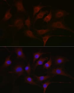 Invitrogen Phosphotyrosine Monoclonal Antibody (4B6C8) 100 &mu;L; Unconjugated:Antibodies,