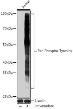 Invitrogen Phosphotyrosine Monoclonal Antibody (4B6C8) 100 &mu;L; Unconjugated:Antibodies,