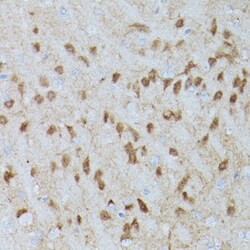 Invitrogen Phospho-ERK1/2 (Thr202, Tyr204) Recombinant Rabbit Monoclonal Antibody (2P8Q2) 100 &mu;L | Buy Online | Invitrogen&trade; | Fisher Scientific