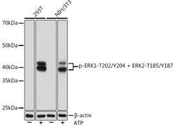Invitrogen Phospho-ERK1/2 (Thr202, Tyr204) Recombinant Rabbit Monoclonal Antibody (2P8Q2) 100 &mu;L | Buy Online | Invitrogen&trade; | Fisher Scientific