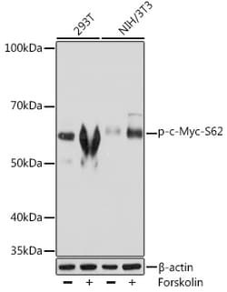 Phospho-c-Myc (Ser62) Recombinant Rabbit Monoclonal Antibody (9L3P1):Antibodies,