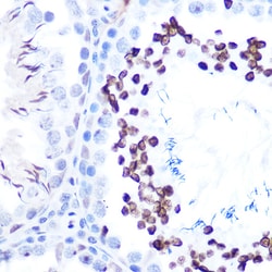 Invitrogen Phospho-STAT1 (Ser727) Recombinant Rabbit Monoclonal Antibody
