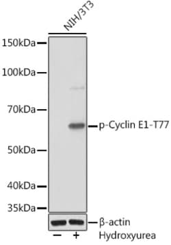 Phospho-Cyclin E (Thr77) Recombinant Rabbit Monoclonal Antibody (ARC1559),