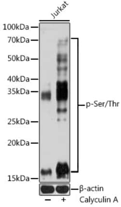 Invitrogen Phosphoserine/threonine Monoclonal Antibody (7A1P3) 100 &mu;L;