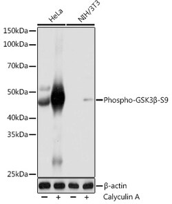 Invitrogen Phospho-GSK3B (Ser9) Recombinant Rabbit Monoclonal Antibody (6U0P1) 100 &mu;L | Buy Online | Invitrogen&trade; | Fisher Scientific