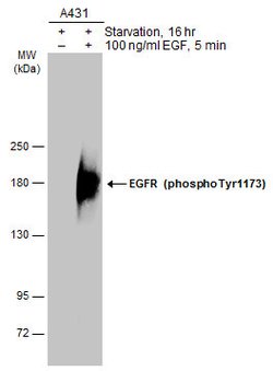 Invitrogen Phospho-EGFR (Tyr1173) Monoclonal Antibody (GT1111) 100 &mu;L;