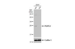 Invitrogen PGP9.5 Monoclonal Antibody (GT448) 100 &mu;L; Unconjugated:Antibodies,