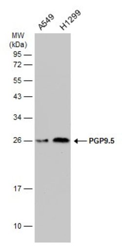Invitrogen PGP9.5 Monoclonal Antibody (GT448) 100 &mu;L; Unconjugated:Antibodies,