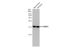 Invitrogen VAMP2 Monoclonal Antibody (GT766) 100 &mu;L | Buy Online | Invitrogen&trade; | Fisher Scientific